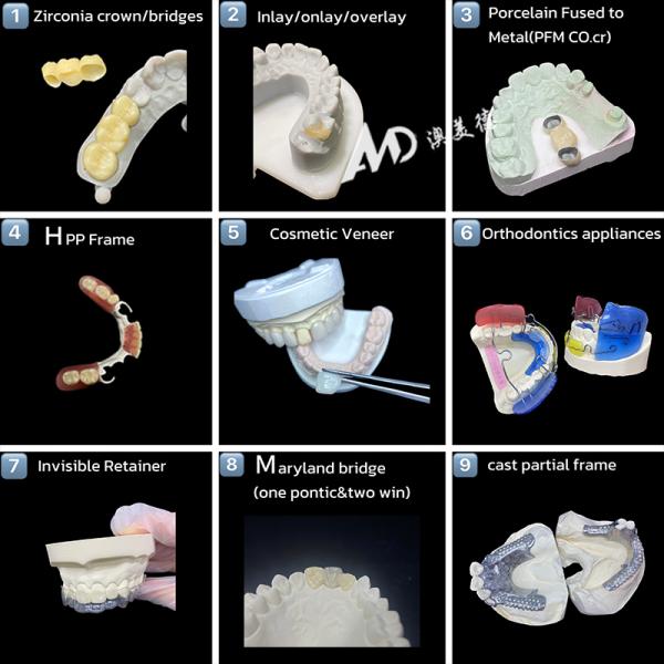 Metal Titanium Crown Precision Strength and Biocompatibility for Lasting Restorations