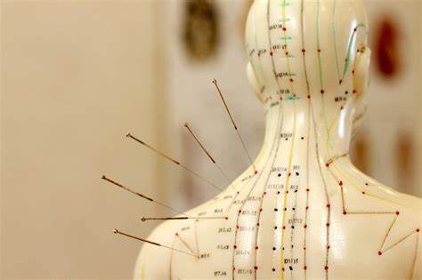 Customizable Stainless Steel Disposable Acupuncture Needles With Guide Tube