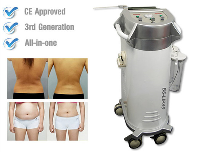 Quality Ultrasonic Laser Power Assisted Liposuction Machine For Losing Weight wholesale