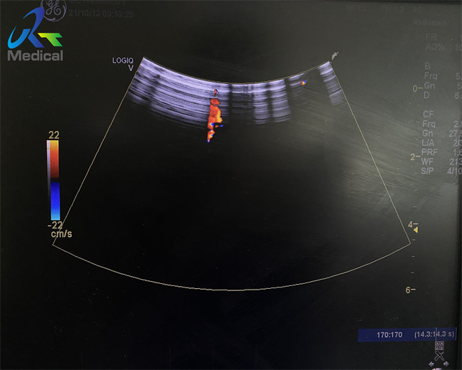 GE 4C-RS Ultrasound Probe Repair For Array Strain Relief Housing Replacement Crystal Damage