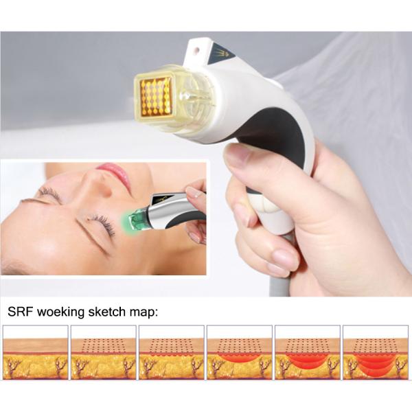 OEM Micro Needle RF Machine , Fractional RF Beauty Machine for Skin Tightening Face Lift