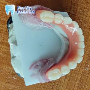 Missing Teeth Acrylic full Denture Restoration Acrylic Complete Denture