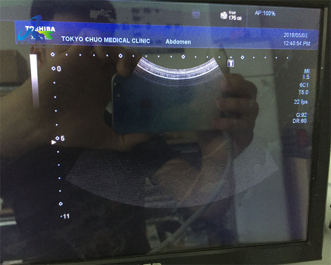6.0MHz Convex Array Ultrasound Transducer Probe Toshiba PVU-375BT