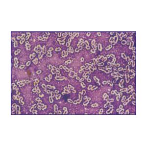 Negative Staining Bacterial Capsule Stain Reagents 2vials×20ml/Kit