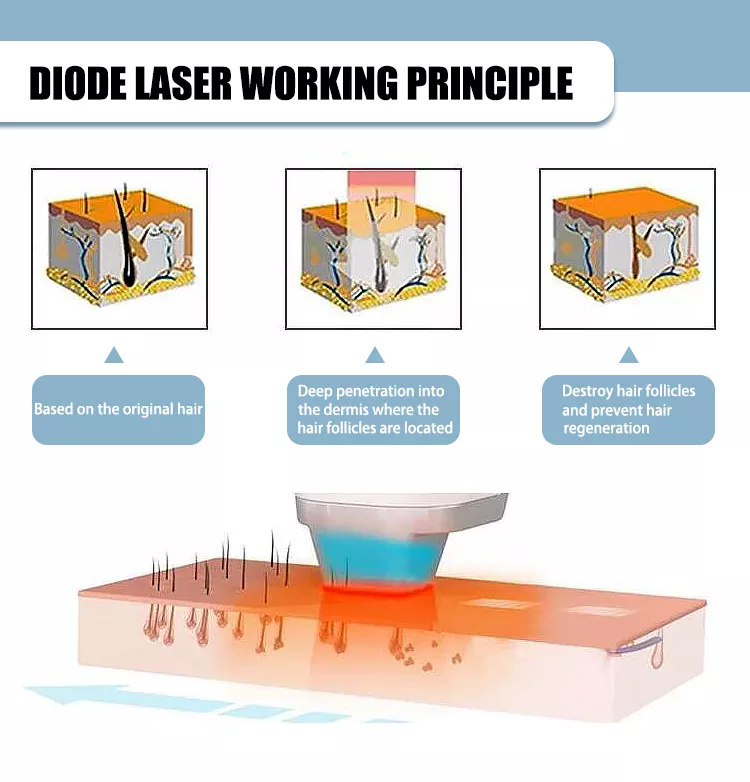 Adjustable 50J IPL Laser Hair Removal For Women Bikini Legs Arms