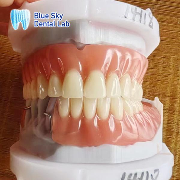 Restoration Full Upper Acrylic Denture Blue Sky Removable Acrylic Denture