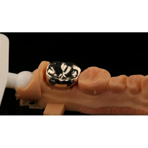 High Nobel Yellow Gold Crown Tooth Professional Ni Be Free ISO And FDA Approved China Dental Lab