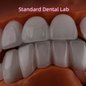 Quality Lithium Dicilicate layer Ivoclar Emax Zirconia Laminate Veneers Translucent OEM ODM wholesale