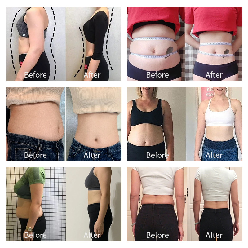 Butt Arm Muscle Sculpting Machine 2 Handles Tesla Ems RF For Tightening Skin Weight Loss