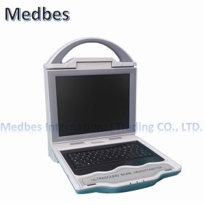 Bone Density Machine Automatic High Effective Portable Ultrasound
