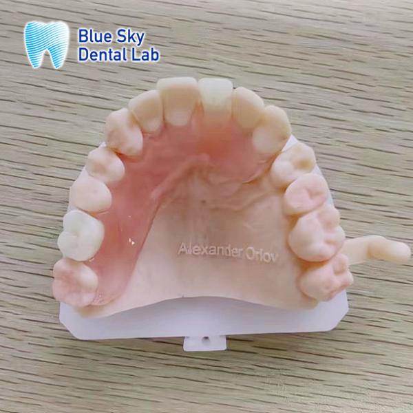 Customize Removable Acrylic Partial Denture Natural Looking Valplast Dental Partials