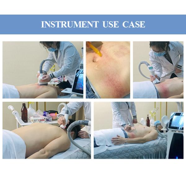 4 In 1 Rf Cellulite Removal Vacuum Roller Massage Vela Slimming Machine Factory