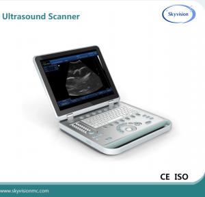 China Full digital B model 3d ultrasound scanner on sale