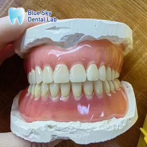 Quality Missing Teeth Acrylic full Denture Restoration Acrylic Complete Denture wholesale