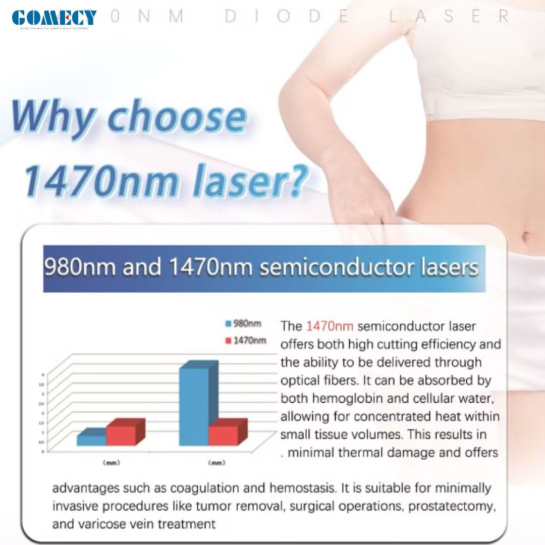 Gomecy 980nm Diode Laser Physiotherapy Machine Blue Light Therapy Pen Varicose Veins Laser Treatment Laser for Nails With Fungus