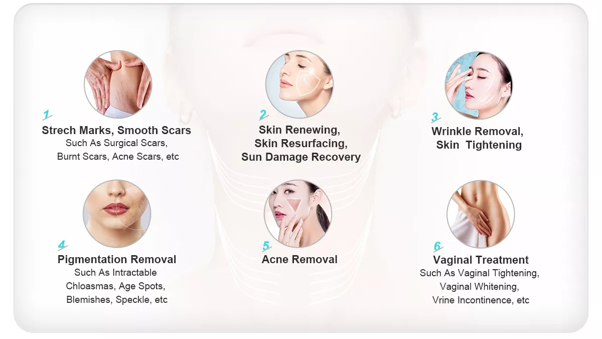 Co2 RF Fractional Laser Machine For Face Treatment Acne Removal