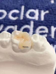 China Dental Composite Inlays And Onlays Ivoclar Nexco High Esthetics on sale