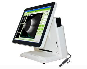 Quality Ophthalmic A/B scanner Ophthalmic ultrasound scanner wholesale