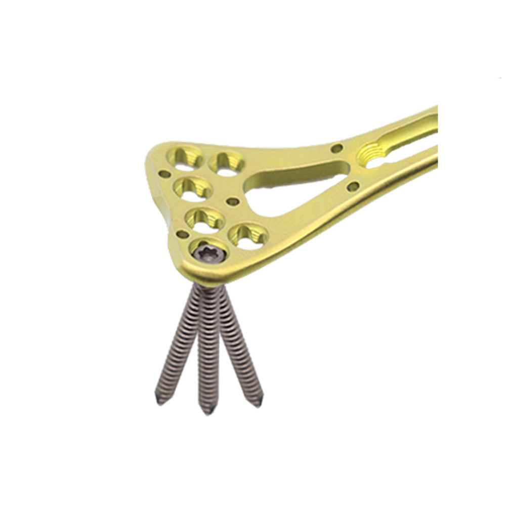 Stainless Steel / Titanium Medical Orthopedic Locking Plate Distal Radius Multi-Axial Implants