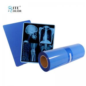 Quality IMATEC Blue PET Inkjet Medical CR X-Ray Radiography Film For Canon Printers wholesale