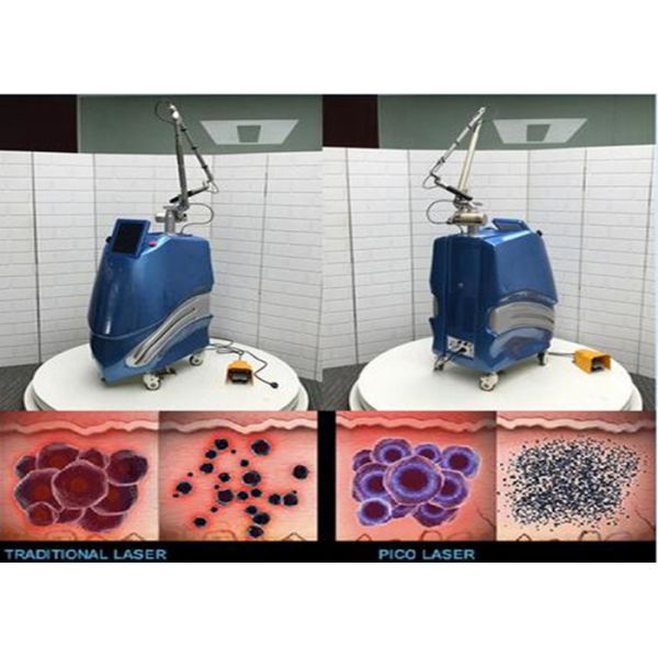 factory directly sales the highest technoloty pulse width 450ps pico laser machine for tattoo removal