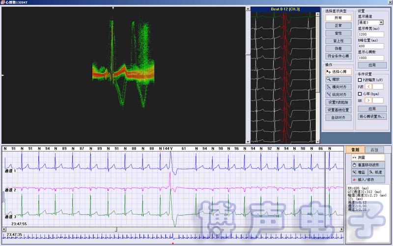 CE Approved 99.9% Accuracy Holter ECG Software 3/12 Channels 24-Hours Ambulatory ECG Holter Monitor