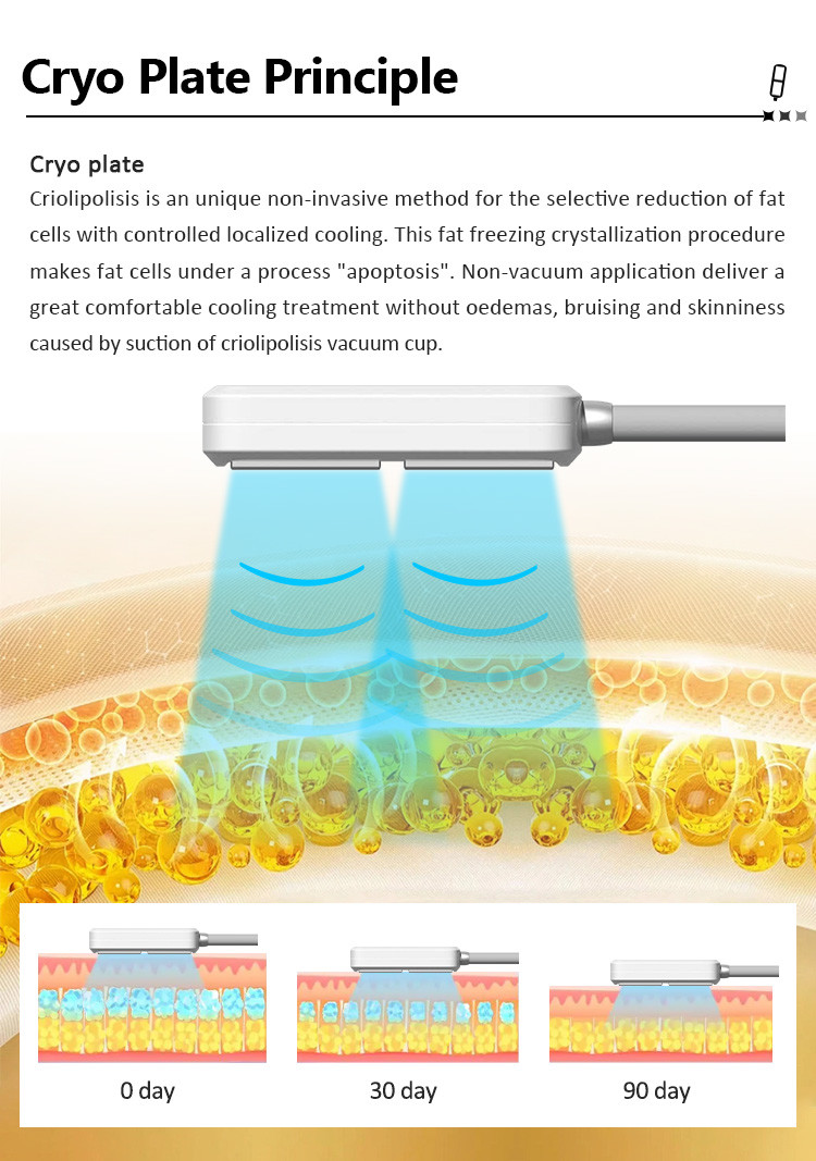 8 Plate 360 Cryolipolysis Cryo Fat Freezing Cryo Plate Weight Loss Machine