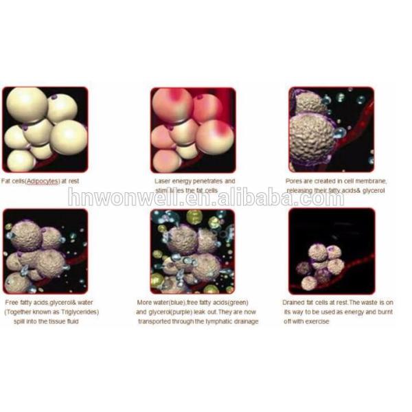 2017 Hottest fat freezing liposuction machine