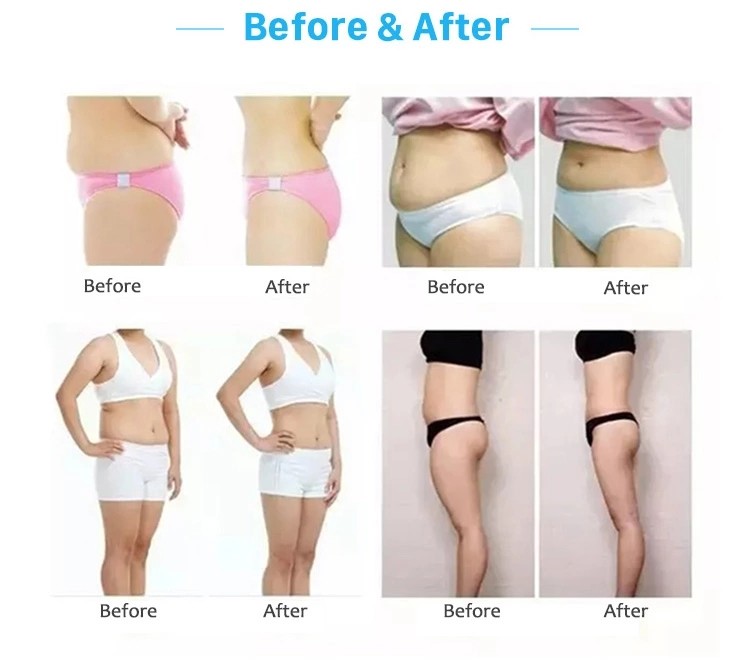beauty salon slim cavitacion radiofrecuencia roller body massager machine shape device body slimming vacuum