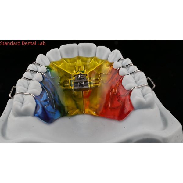 Teeth Expansion And Distalization Orthodontist Palate Expander China Dental Lab