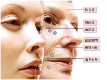 Deep Injection Hyaluronic Acid Dermal Fillers For Buttocks Enhancement 20ml