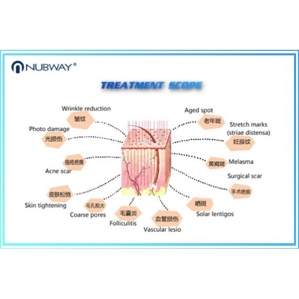 30w Fractional Co2 Laser Nubway Products Vaginal Applicator