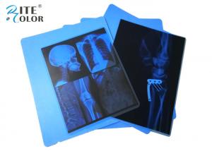 China Inkjet PET Medical Imaging Blue X Ray Film For Canon Pixma Printers on sale