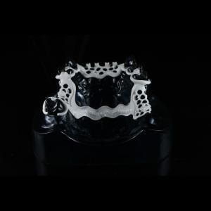 Quality OEM Peek Cast Metal Framework Partial Denture User Friendly wholesale