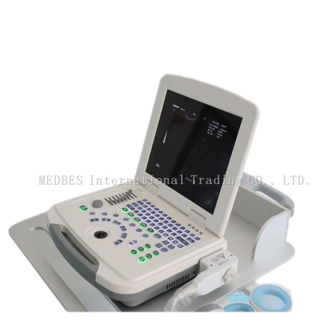 80 elements Ultrasound Scanner Laptop Ultrasound Scanner B580 with Battery