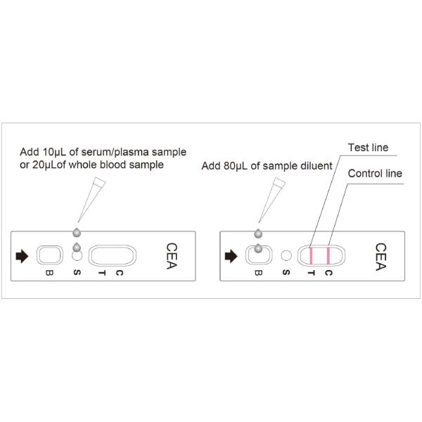 20min TUV Carcino Embryonic Antigen CEA Rapid Test Kit