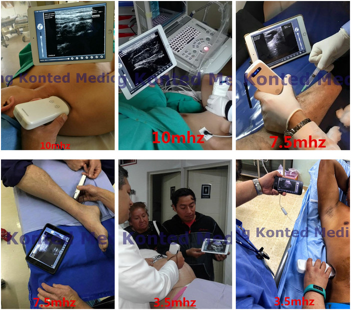 GH Medical Hospital Equipments G10LN 128E Linear Wireless Vascular Probe Ultrasound 10Mhz