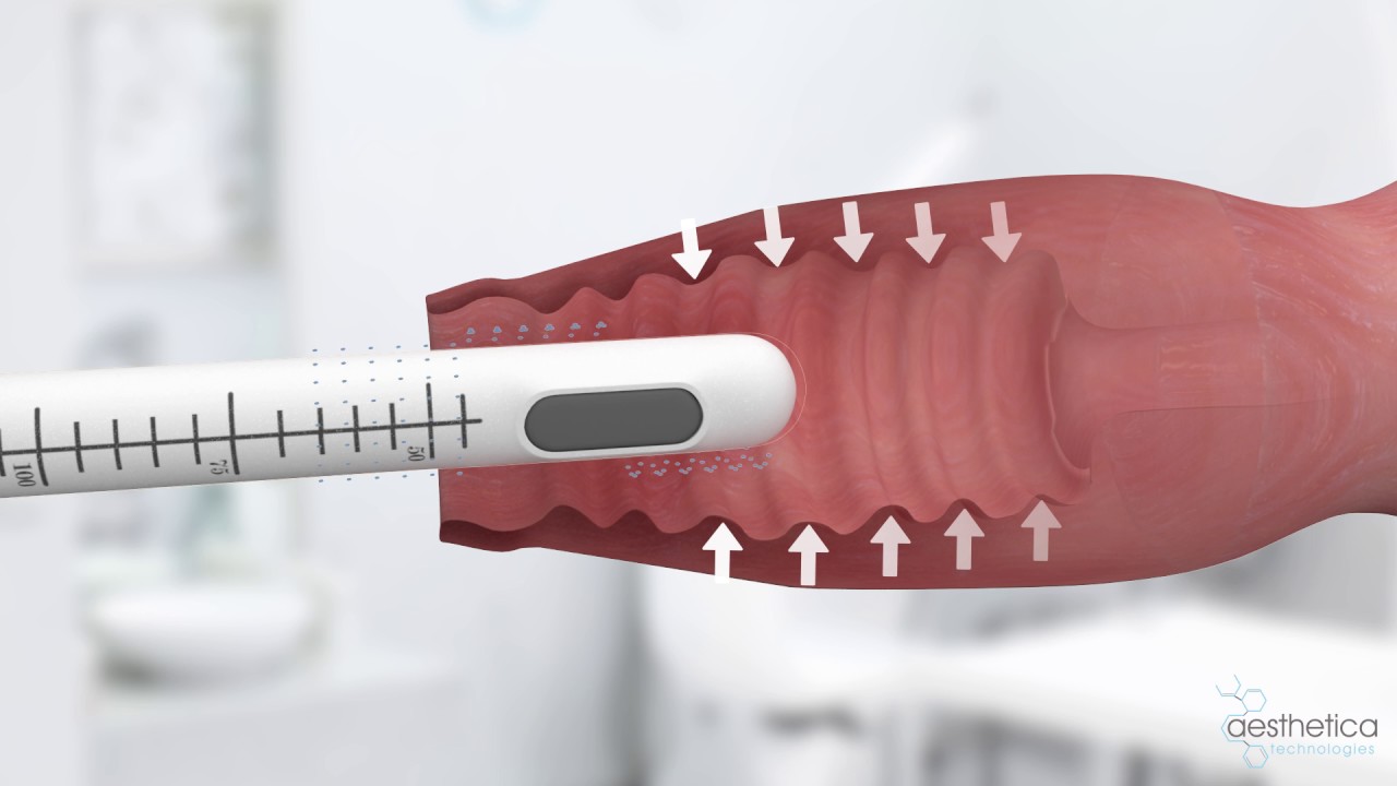 5 In 1 / 4 In 1 Hifu Lipo Slimming Machine 4D Ultra Sonic Hifu Therapy For Face Lift Tighten Skin Fat Loss Machine