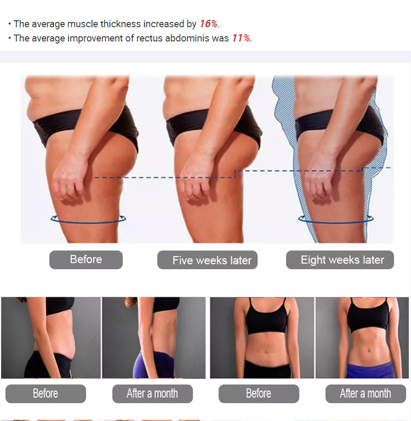 Muscle Sculptinging Body Machine , 13 Tesla 4 Handle Fat Freezing Machine