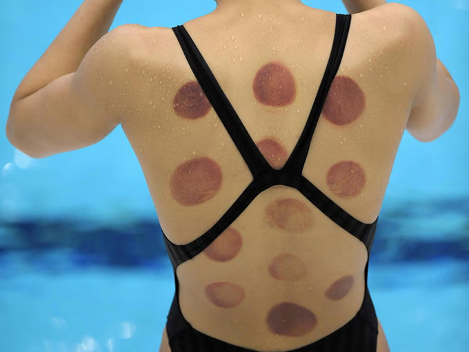 Tens Electrotherapy Microcurrent Russian Waves Muscle Stimulation Cupping Therapy Massager