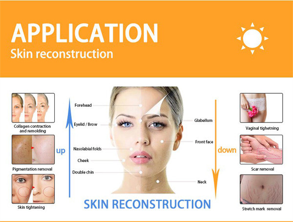 Skin Rejuvenation CO2 Fractional Laser Machine Air Cooling 30W