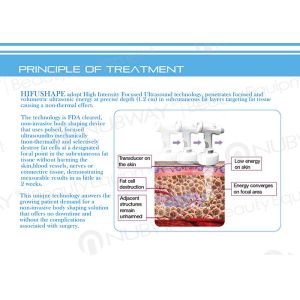 2015 Newest! HIFU High Intensity Focused Ultrasound System