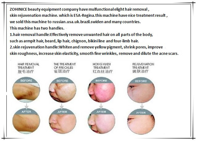 Skin Care Multi Function Beauty Equipment E-light IPL RF , Hair Removal Machine