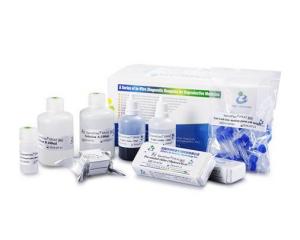 Quality 40 Tests / Kit SCD Method Sperm DNA Fragmentation Test Kit Wright Staining Dye wholesale