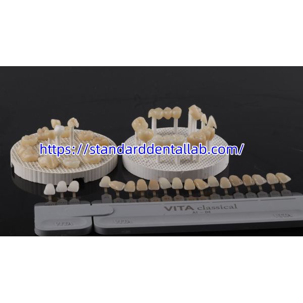 FDA High Esthetics Dental Zirconia Bridge With Layered Porcelain zirconia dental crown China Dental Lab