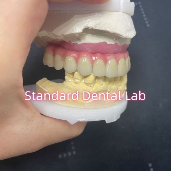 Malo Bridge Hybrid Zirconia All On Four / Six Zirconia Implant Bridge TItanium Bar