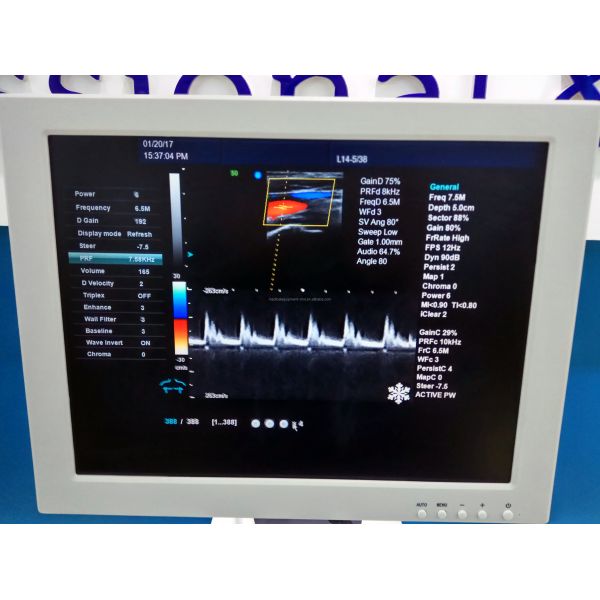 4D Color Doppler Ultrasound Machine Obstetrics And Gynecology Equipment Hospital