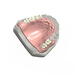 China Removable Dental Partial Denture Natural Color 3D Dental Model Customized on sale