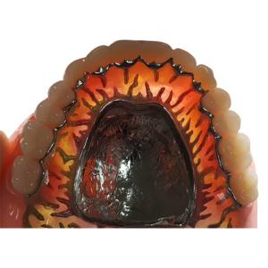 China Full Removable FDA 3014652903 Composite Resin Crown Denture Teeth on sale