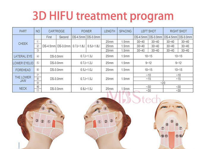 3d 11 Lines Anti Wrinkle Ultrasound Facelift HIFU Facial Machine
